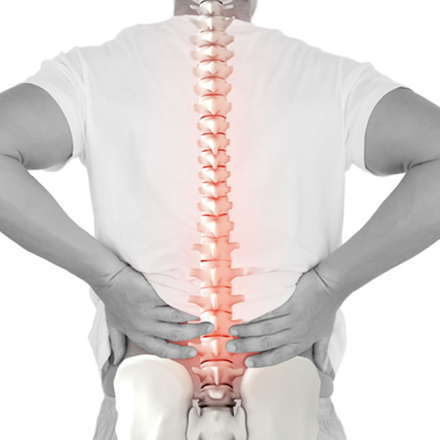 脊椎脊髄の病気イメージ